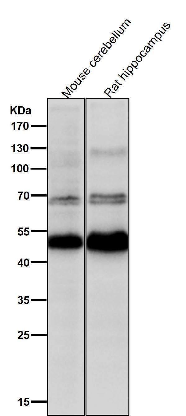 Anti-CHX10 Rabbit Monoclonal Antibody Boster Bio