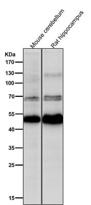 Anti-CHX10 Rabbit Monoclonal Antibody Boster Bio