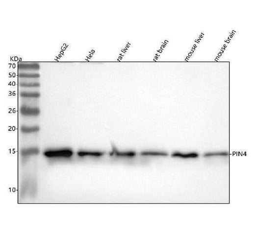 Anti-PIN4 Rabbit Monoclonal Antibody Boster Bio