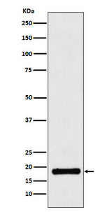 Anti-UBE2B Rabbit Monoclonal Antibody Boster Bio