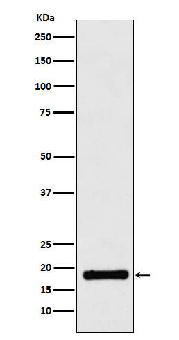 Anti-UBE2B Rabbit Monoclonal Antibody Boster Bio