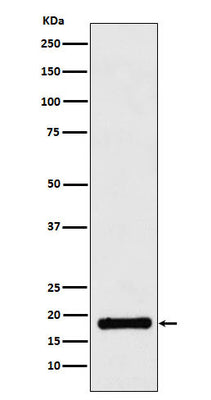 Anti-UBE2B Rabbit Monoclonal Antibody Boster Bio