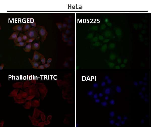 Anti-USP11 Monoclonal Antibody Boster Bio