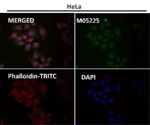 Anti-USP11 Monoclonal Antibody Boster Bio