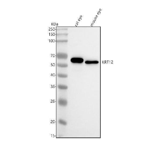 Anti-Cytokeratin 12 Rabbit Monoclonal Antibody Boster Bio