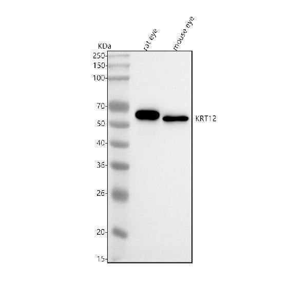 Anti-Cytokeratin 12 Rabbit Monoclonal Antibody Boster Bio