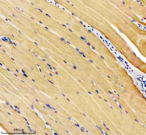Anti-Calsequestrin 1 Monoclonal Antibody Boster Bio