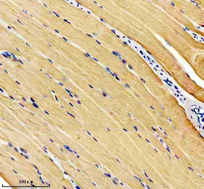 Anti-Calsequestrin 1 Monoclonal Antibody Boster Bio
