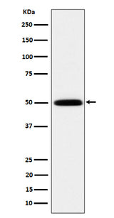 Anti-HARS Rabbit Monoclonal Antibody Boster Bio