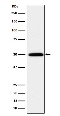 Anti-HARS Rabbit Monoclonal Antibody Boster Bio