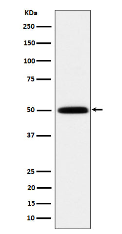 Anti-HARS Rabbit Monoclonal Antibody Boster Bio