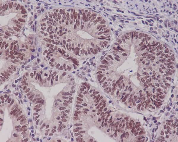Anti-Pygopus 2 Rabbit Monoclonal Antibody Boster Bio