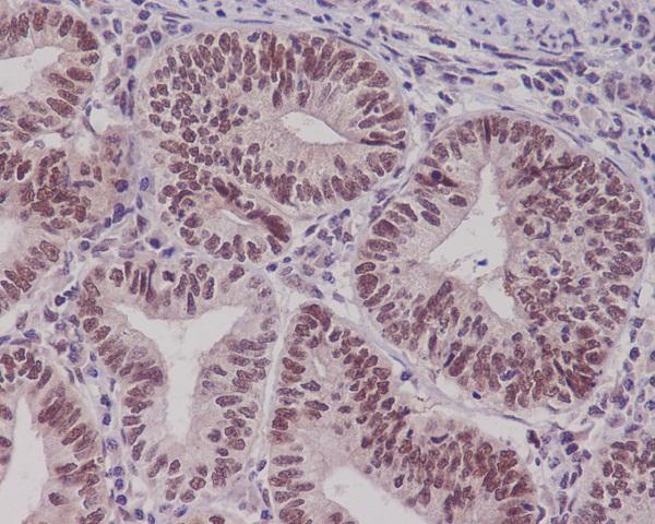 Anti-Pygopus 2 Rabbit Monoclonal Antibody Boster Bio