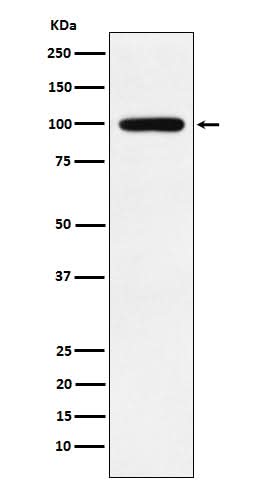 Anti-Calmegin Rabbit Monoclonal Antibody Boster Bio