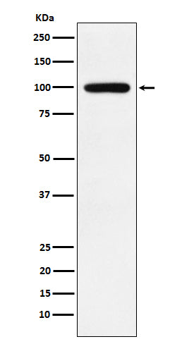 Anti-Calmegin Rabbit Monoclonal Antibody Boster Bio