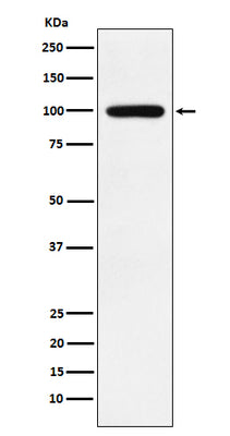 Anti-Calmegin Rabbit Monoclonal Antibody Boster Bio