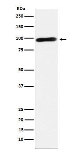 Anti-Calmegin Rabbit Monoclonal Antibody Boster Bio