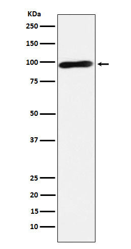 Anti-Calmegin Rabbit Monoclonal Antibody Boster Bio
