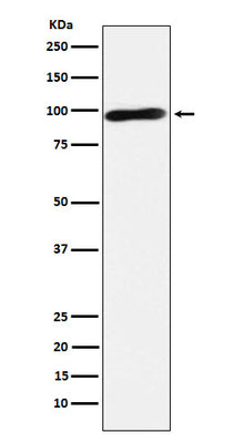 Anti-Calmegin Rabbit Monoclonal Antibody Boster Bio
