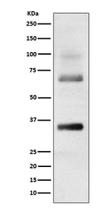 Anti-Loricrin Rabbit Monoclonal Antibody Boster Bio
