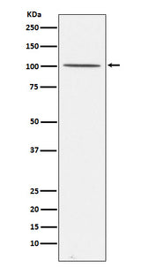 Anti-Gemin 3 Rabbit Monoclonal Antibody Boster Bio