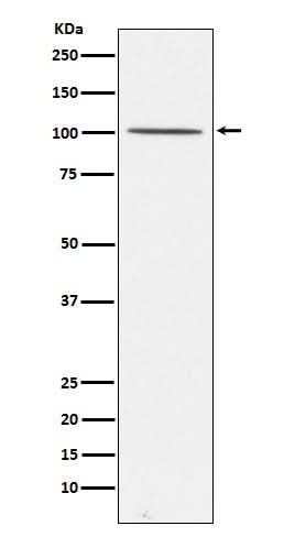 Anti-Gemin 3 Rabbit Monoclonal Antibody Boster Bio