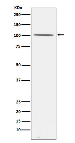 Anti-Gemin 3 Rabbit Monoclonal Antibody Boster Bio