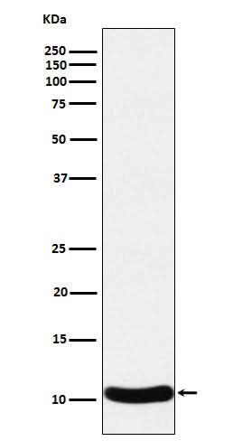 Anti-CCL27 Rabbit Monoclonal Antibody Boster Bio
