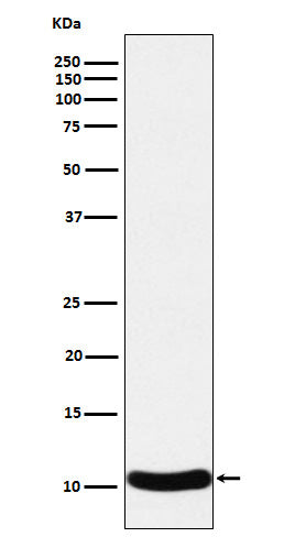 Anti-CCL27 Rabbit Monoclonal Antibody Boster Bio