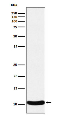 Anti-CCL27 Rabbit Monoclonal Antibody Boster Bio