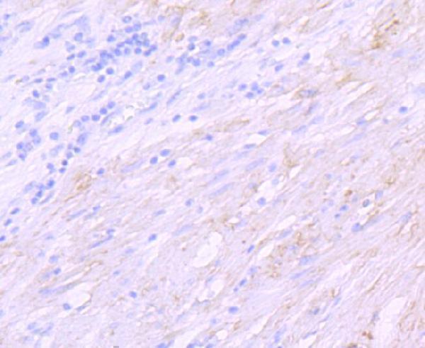 Anti-delta Sarcoglycan SGCD Rabbit Monoclonal Antibody Boster Bio
