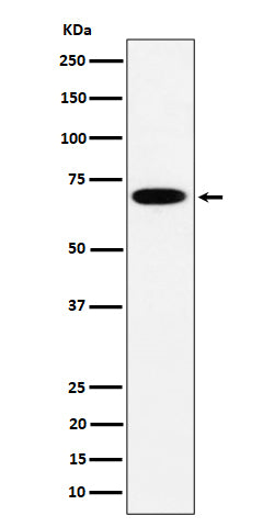 Anti-SLC27A4 Rabbit Monoclonal Antibody Boster Bio