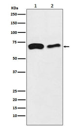 Anti-SLC27A4 / FATP4 Rabbit Monoclonal Antibody Boster Bio