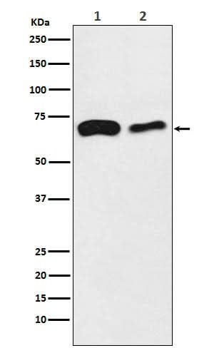 Anti-SLC27A4 / FATP4 Rabbit Monoclonal Antibody Boster Bio