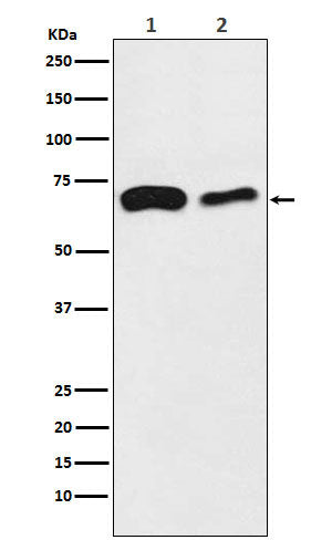 Anti-SLC27A4 / FATP4 Rabbit Monoclonal Antibody Boster Bio