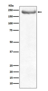 Anti-NEFH/Nf H Rabbit Monoclonal Antibody Boster Bio