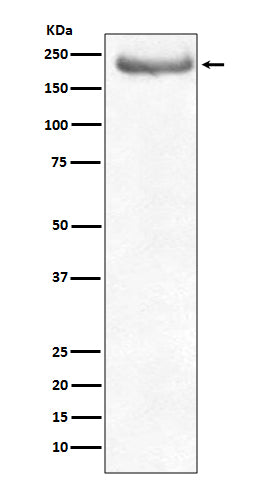 Anti-NEFH/Nf H Rabbit Monoclonal Antibody Boster Bio
