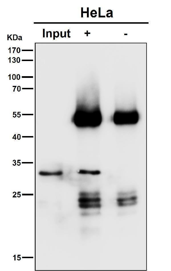 Anti-SNAP29 Rabbit Monoclonal Antibody Boster Bio