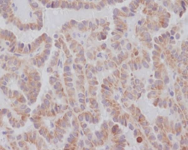 Anti-KIFC1 Rabbit Monoclonal Antibody Boster Bio