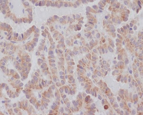 Anti-KIFC1 Rabbit Monoclonal Antibody Boster Bio