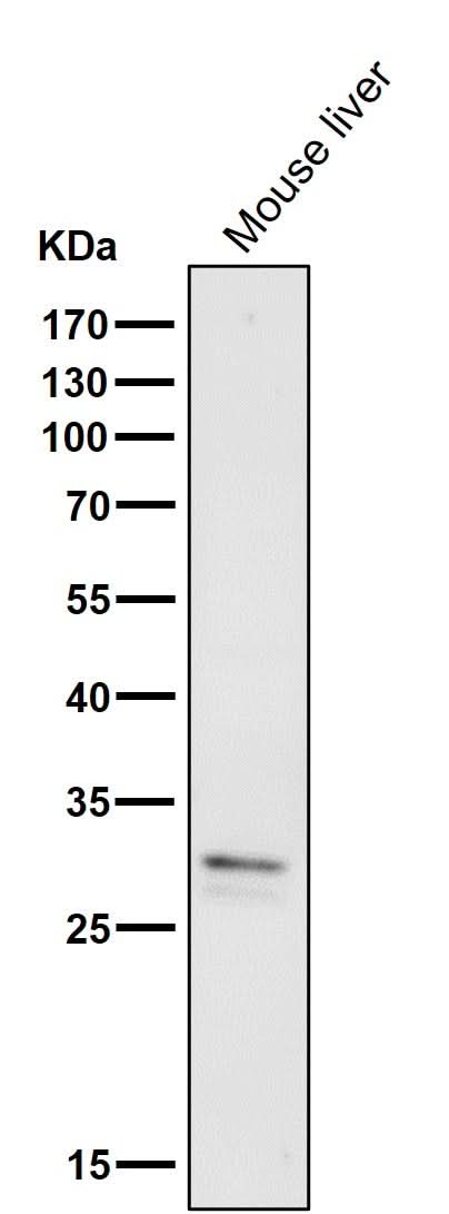 Anti-VAPA Rabbit Monoclonal Antibody Boster Bio