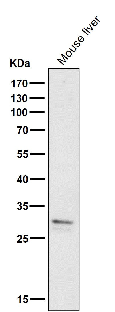 Anti-VAPA Rabbit Monoclonal Antibody Boster Bio