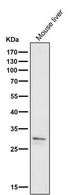 Anti-VAPA Rabbit Monoclonal Antibody Boster Bio