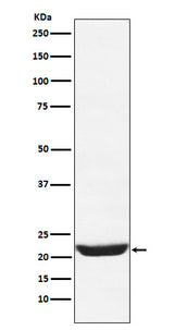 Anti-NCS1 Rabbit Monoclonal Antibody Boster Bio