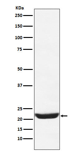 Anti-NCS1 Rabbit Monoclonal Antibody Boster Bio