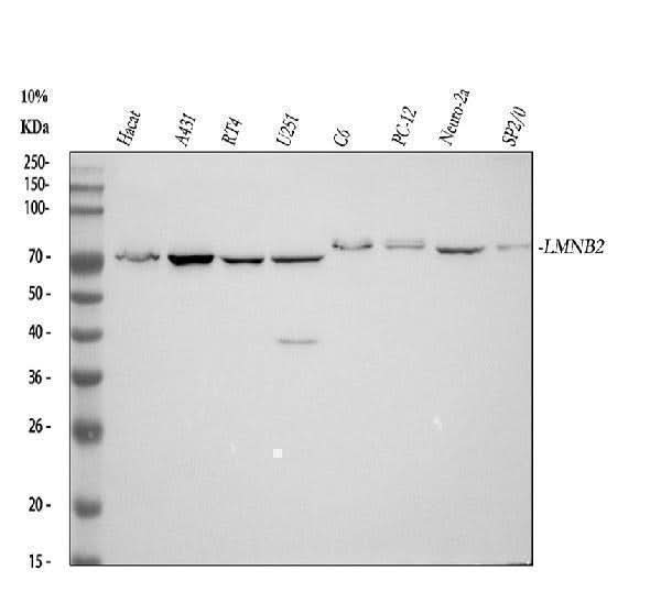 Anti-Lamin B2 Monoclonal Antibody Boster Bio