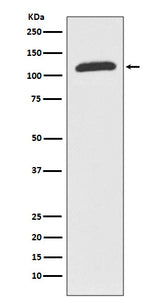 Anti-ABCF1 Rabbit Monoclonal Antibody Boster Bio