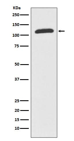 Anti-ABCF1 Rabbit Monoclonal Antibody Boster Bio