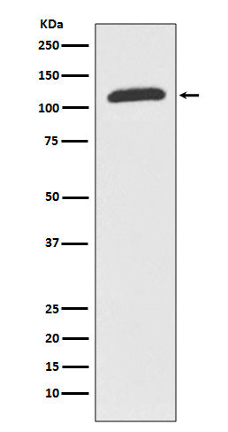 Anti-ABCF1 Rabbit Monoclonal Antibody Boster Bio