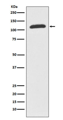 Anti-ABCF1 Rabbit Monoclonal Antibody Boster Bio